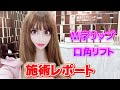 【唇整形】M字リップ形成と口角リフトの施術を受けてきました!
