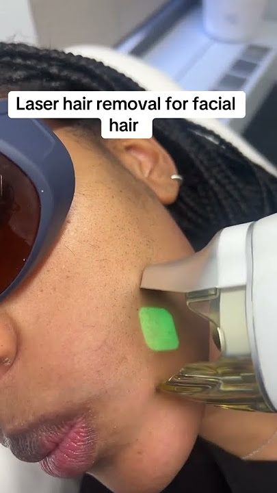 See how a 1064nm Ndyag Laser for laser hair removal  works on a black woman's skin