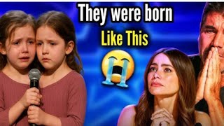 Conjoined twins shock Everyone- No one could hold Back Tears #talent #fyp 
