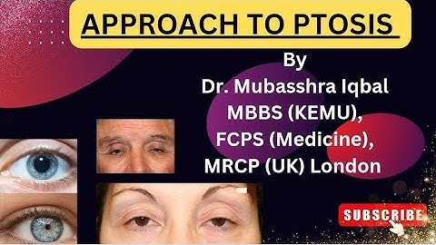 Diagnostic Approach to Ptosis | Ptosis (drooping of upper eyelids) Etiology, Diagnosis, Treatment