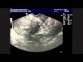 Baby Coskey - 9 week fetus