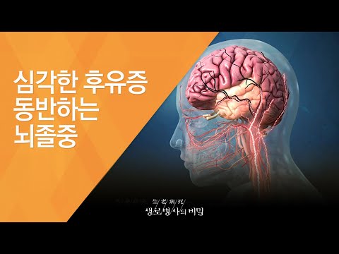 심각한 후유증 동반하는 뇌졸중 - (2015.11.18_562회 방송)_뇌졸중, 당신은 안전하십니까?