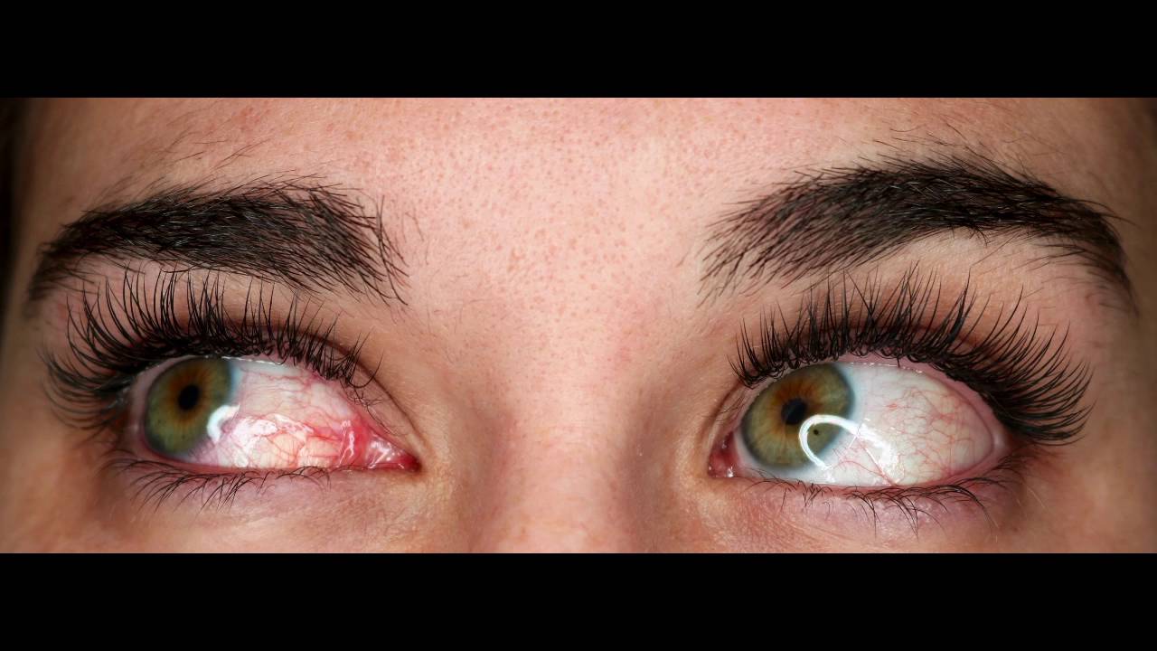 Eyelash Extensions Before and After 