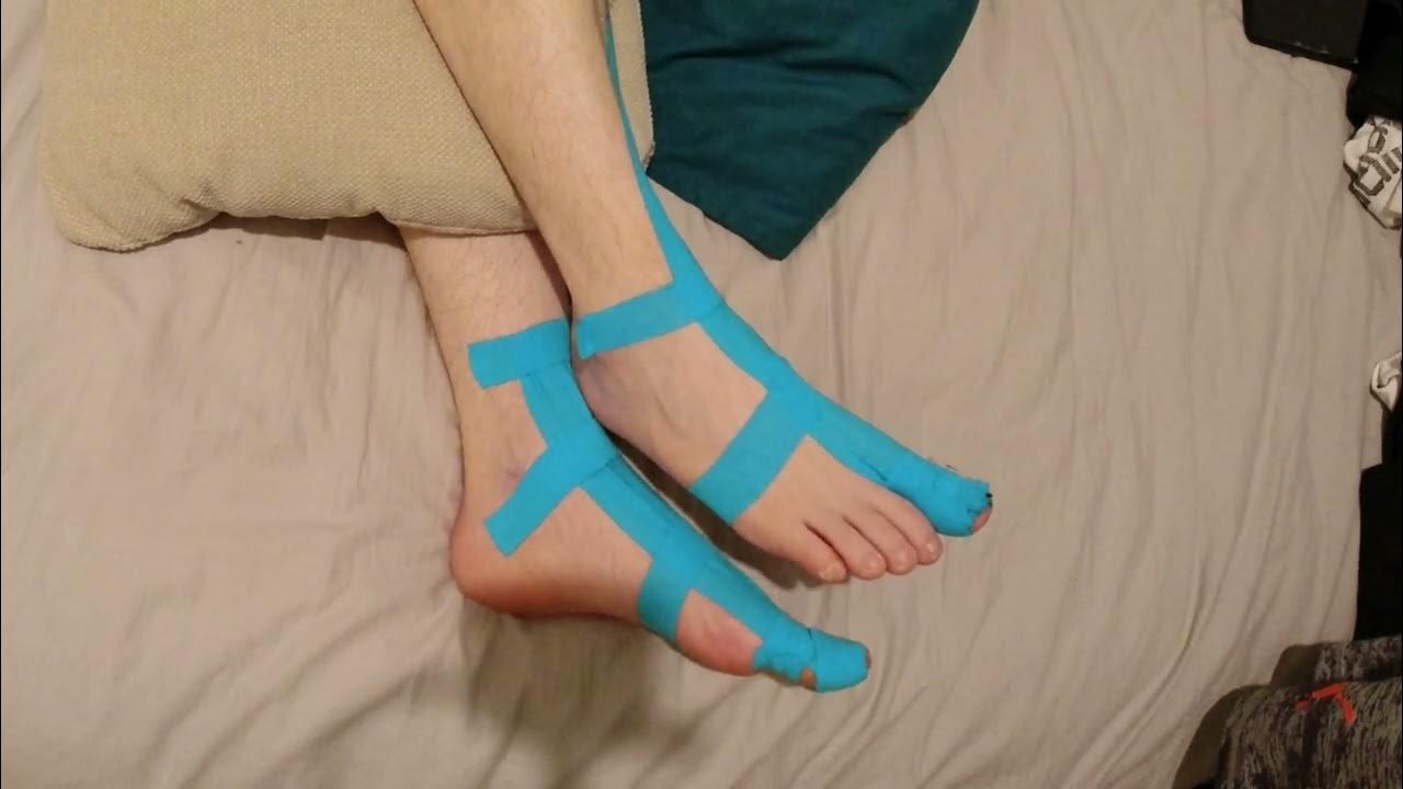 Legs twitching in the night Painful legs and moving toes (PLMT)? YouTube