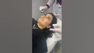 اضف الى جمالك جمال غمازة حقيقة في مركز الترا كير Dimple Gamze 