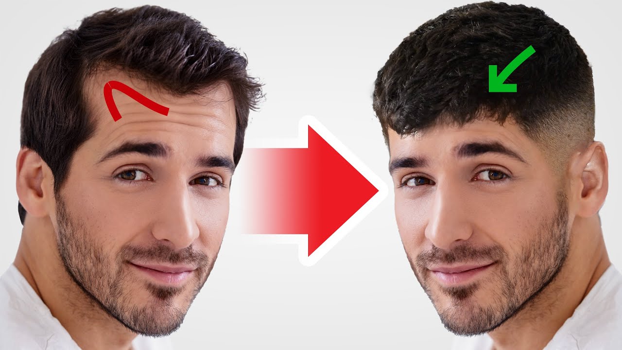 Best Haircut and Styling Tips for Men with Receding Hairlines - Scalp  Designs: