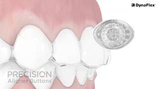 Precision Aligner Buttons - Clear