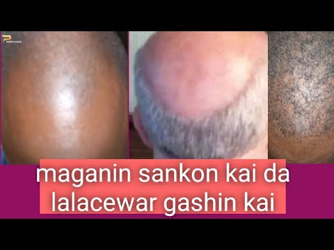 INA MASU SANKO A KAI da maganin lalacewa da karyewar gashi