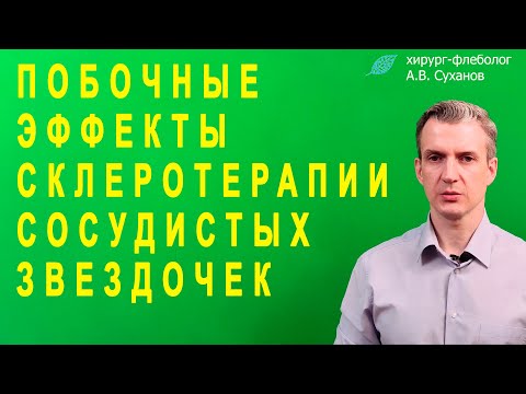 Какие Побочные Эффекты Склеротерапии Сосудистых Звездочек?