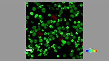 Interaction between HIV Env-Expressing T Cells and Macrophages Allows Cytoplasmic Dye Exchange