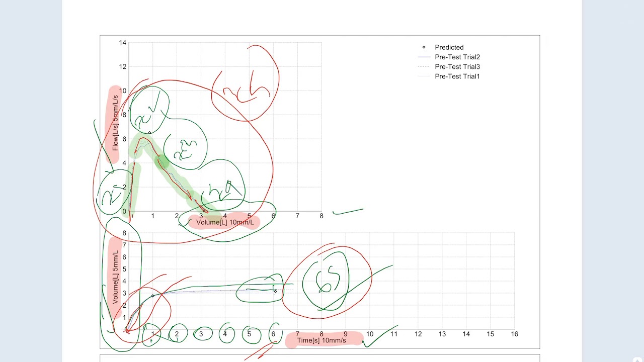 Spirometry bangla tutorial স্পাইরোমেট্রি টিউটোরিয়াল বাংলায় YouTube