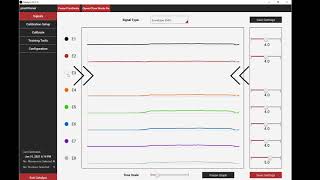 Patient Evaluation for IBT's Sense Pattern Recognition System: Viewing Signals and Calibrating