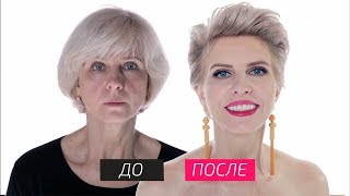 На 10 лет моложе - Одномоментная установка имплантов с одномоментной аутентацией 3 d костной ткани На 10 лет моложе - Одномоментная установка имплантов с одномоментной аутентацией 3 d костной ткани