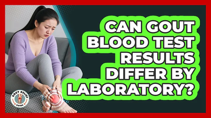 Can Gout Blood Test Results Differ By Laboratory? - Gout Relief Guide