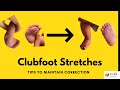 How to do Clubfoot Stretches- Parent information to avoid relapses. Post Ponseti exercises.  #shorts
