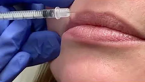 Fort Worth, Texas dermatologist performs Botox for...