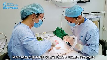 IMPLANT l LIÊN TIẾP CÁC CA CẮM TRỤ IMPLANT CHO KHÁCH HÀNG VIỆT KIỀU l HỆ THỐNG NHA KHOA NỤ CƯỜI VIỆT