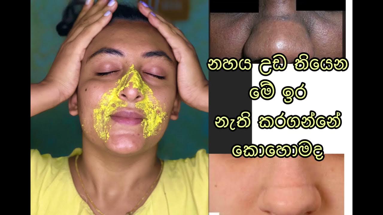 Treatment Of Dark Line Across The Nose YouTube treatment-of-dark-line-across-the-nose-youtube