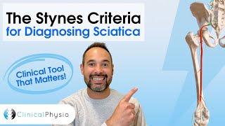 Stynes Criteria Explained Diagnosing Sciatica For Physiotherapists