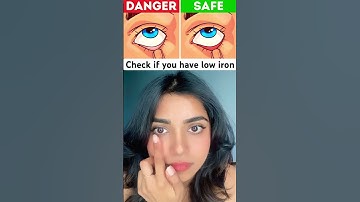 Quick Check: Do You Have Low Iron? #shorts