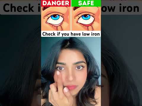 Quick Check: Do