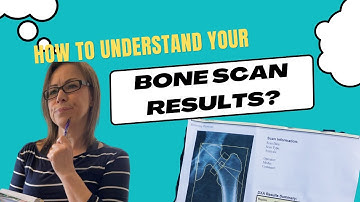 DEXA scan - understand your results with our Physio Led Pilates Expert - Osteoporosis