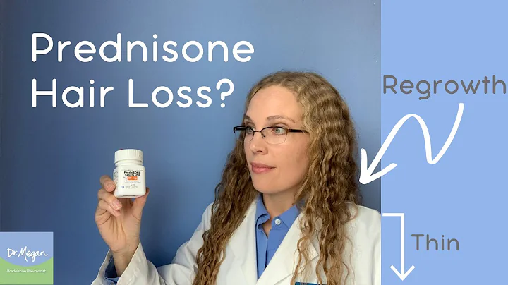 Prednisone Hair Loss? 👱‍♀️ to 👩‍🦲 (Side Effect)