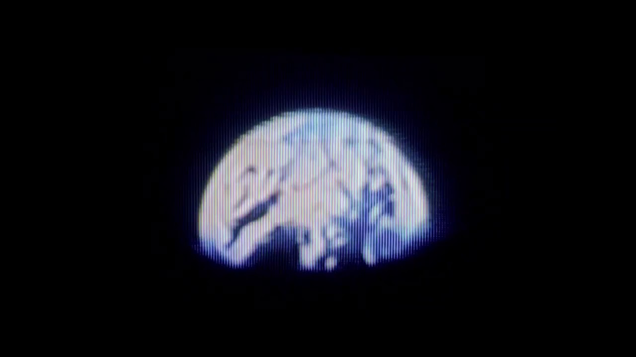 𝘐₵𝘠𝘔𝘖𝘕𝘌𝘠 - YouTube