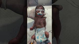 #PrematureBaby #VLBW #NICUCare #NewbornCare #PreemieBaby #BabyCare #NICUNurse #PrematureBirth
