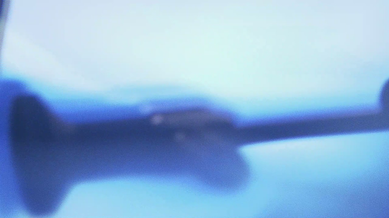 laparoscopic appendicectomy subhepatic part 3