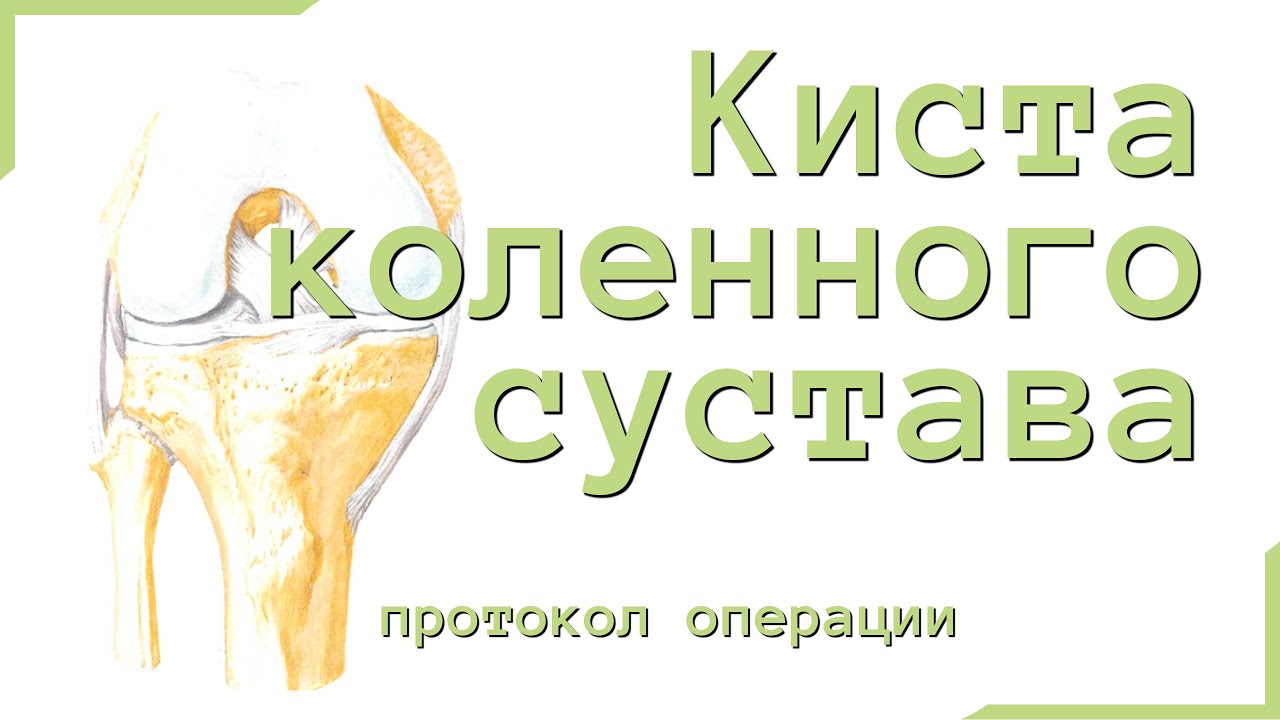 киста передней поверхности коленного сустава