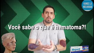 Varicoso e hematomas eczema