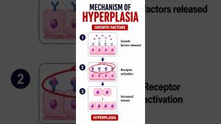 Mechanism of Hyperplasia | Growth Factors Explained