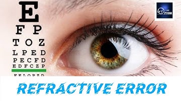 What is happening inside of our eyes?? | Refractive Error | Awareness | EYE CARE OPTOM | Tamil