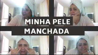 Pele com mancha testando o creme que ganhei