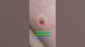 Rết độc cắn chết người - Câu chuyện có thật | Thỏ thúi tv