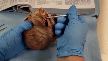External and Internal Features of the Heart