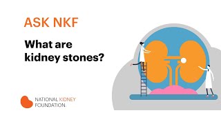 What are kidney stones? | National Kidney Foundation