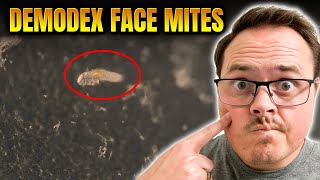 CAN'T UNSEE!! Finding FACE MITES with my compound MICROSCOPE
