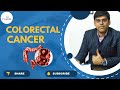 Understanding Colorectal Cancer: Symptoms, Causes, and Prevention#doctor #healthyliving