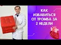 Как избавиться от тромба за 2 недели. Флеболог. Москва.