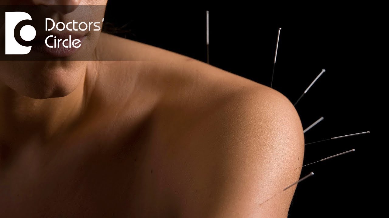 How Long Should I Wait To Workout After Acupuncture