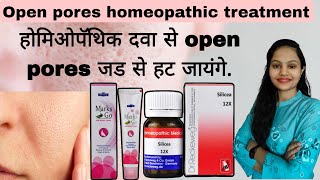 Homeopathic Treatment for open pores| silicea 12X and marks go cream for open pores 