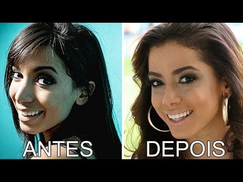 Vídeo: As 25 Principais Celebridades Antes E Depois De Cirurgia Plástica E Trabalhos De Nariz