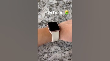 Thumbnail of The most comfortable Apple Watch band you'll ever wear
