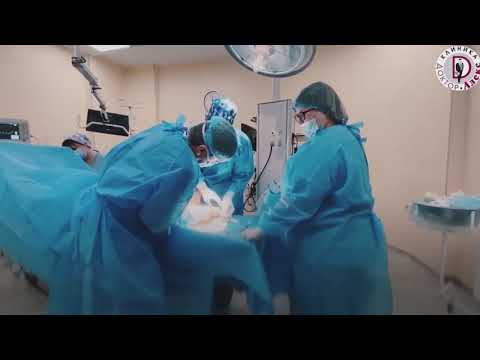 Вальгусная деформация стопы или Hallux valgus