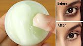 DIY Under Eye Cream to Remove Dark Circles and Fine Lines in 7 Days - YouTube