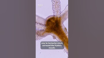 A Microorganism With Stretchy Tentacles