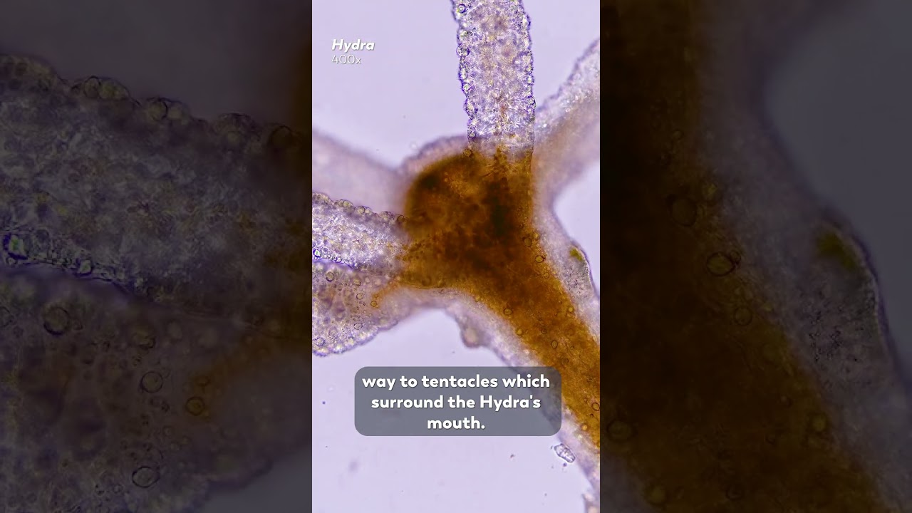 A Microorganism With Stretchy Tentacles