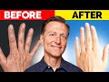 The Ultimate Hand Transformation â€“ Dr. Berg's Best Remedy for Dryness and Wrinkles